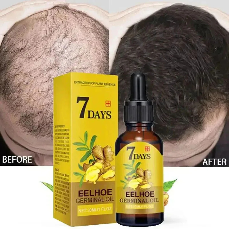 Hair Care Essential Oil Atomizing - Сыворотка для быстрого роста волос за
