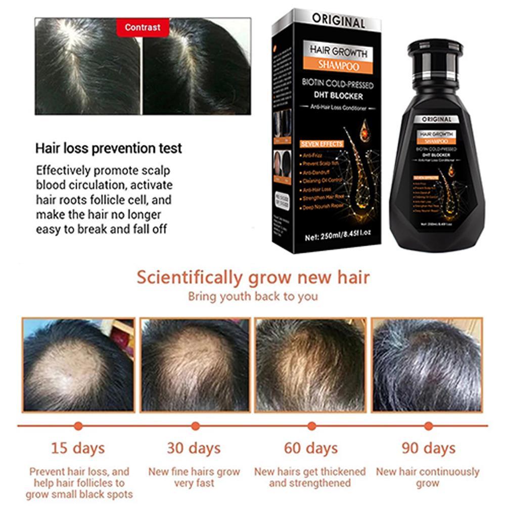 Биотин имбирный шампунь, форму – обзор и цена Biotin Shampoo Thickening